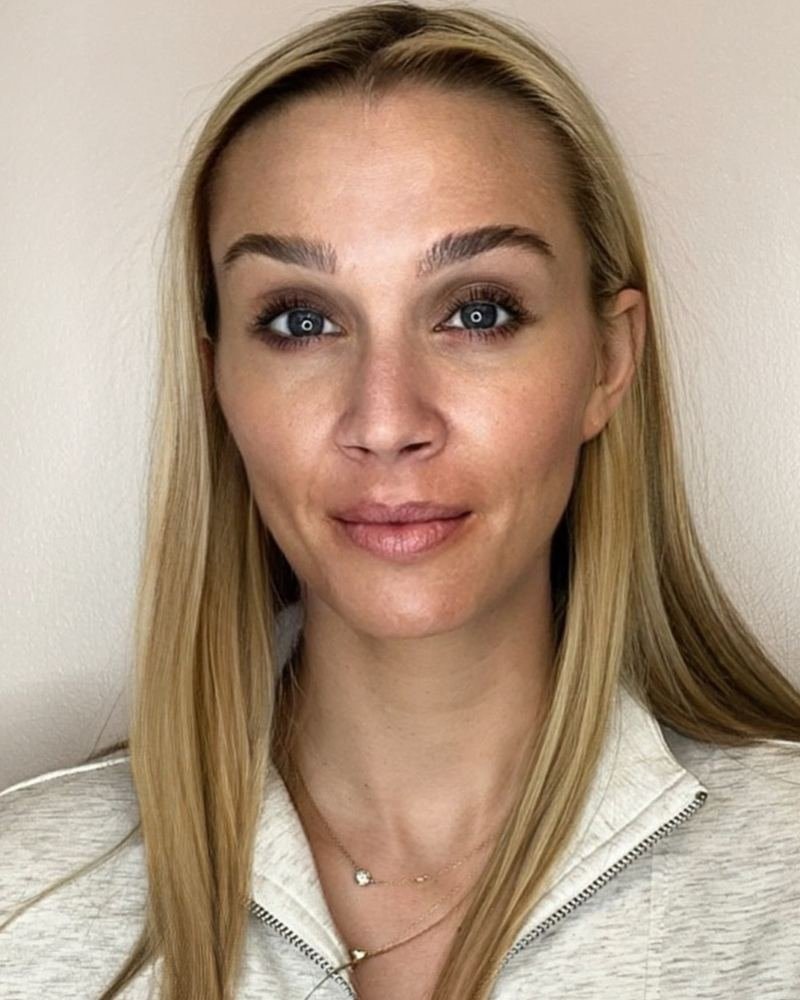 Wrinkle relaxer after, ZK client